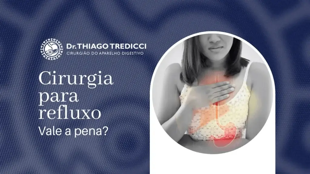 Cirurgia para refluxo: Vale a pena considerar? - Blog Dr. Thiago Tredicci