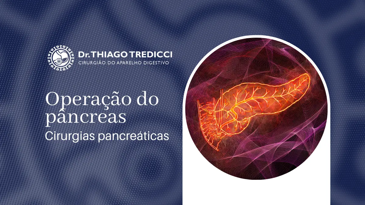 Operação do pâncreas: Quando é indicada? - Blog Dr. Thiago Tredicci